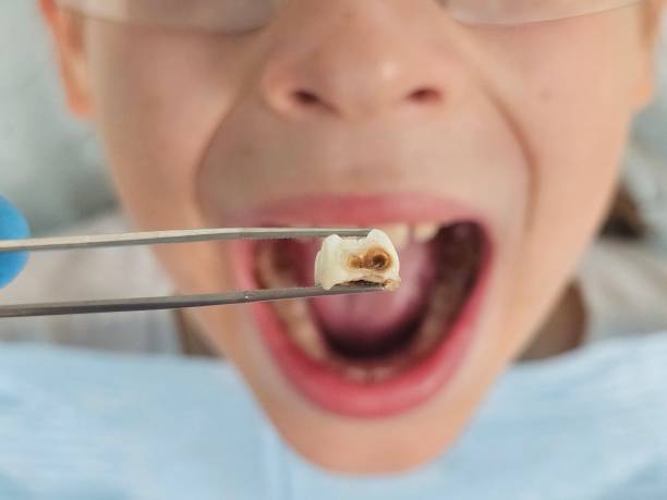 Emergency Dentist for Kids in TX